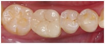 Mercury-free Materials